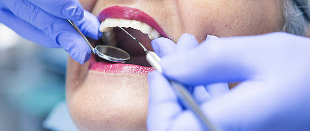 Best Emergency Root Canal Treatment in Temperance, MI